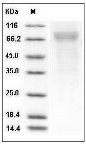 Cynomolgus Thrombopoietin / THPO / TPO Protein (His Tag) SDS-PAGE