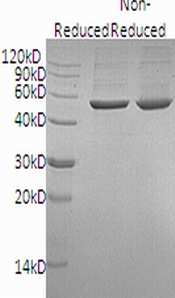 Human PGD/PGDH (His tag) recombinant protein