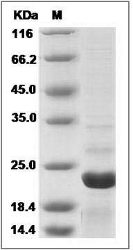 Human ARF3 / ADP-ribosylation factor 3 Protein (His Tag) SDS-PAGE
