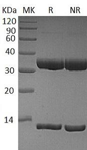 Human FcRn & B2M Heterodimer (His tag) recombinant protein