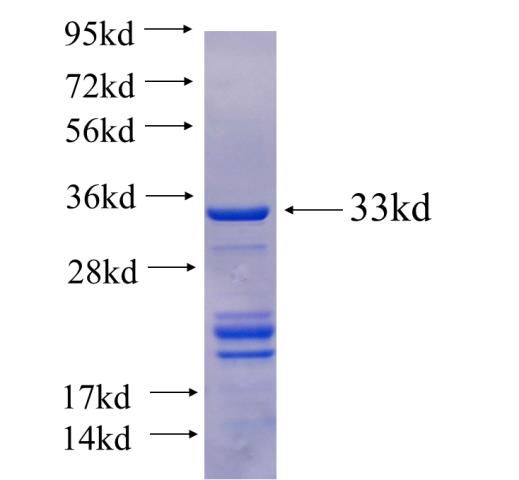 Recombinant human CWC15(Full length) SDS-PAGE