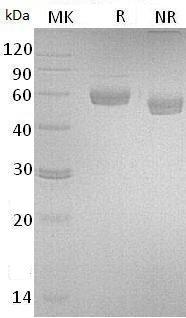 Human PSG3 (His tag) recombinant protein
