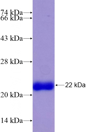 Recombinant Human MEX3C SDS-PAGE