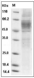 Human GPR56 / TM7LN4 Protein (His Tag) SDS-PAGE