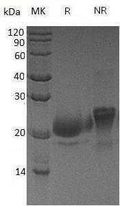 Human WFDC2/HE4/WAP5 (His tag) recombinant protein