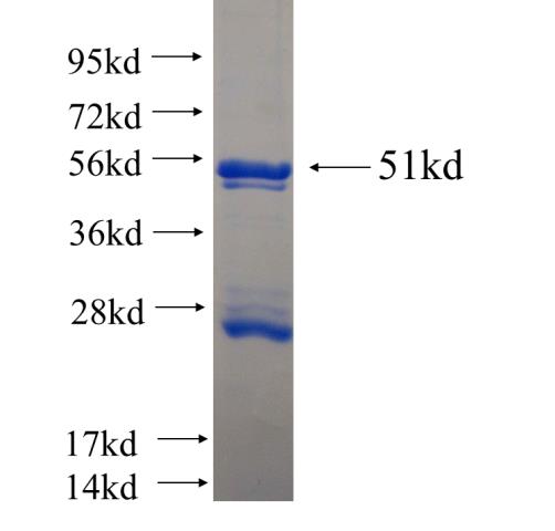 Recombinant human REDD1 SDS-PAGE