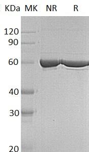 Human PKLR/PK1/PKL (His tag) recombinant protein