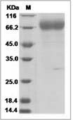 Influenza A H3N2 (A/Hong Kong/CUHK31987/2011) Hemagglutinin / HA1 Protein (His Tag)