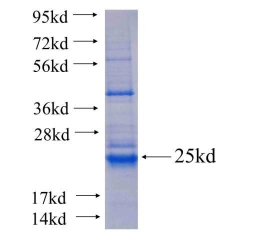 Recombinant human MRPS24(Full length) SDS-PAGE