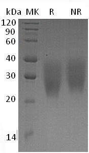 Human LRRC25/MAPA/UNQ6169/PRO20174 (His tag) recombinant protein