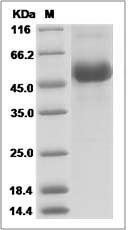 Influenza A H5N8 (A/duck/Jiangsu/k1203/2010) Hemagglutinin / HA1 Protein (His Tag)