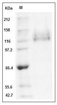 Human ITGA6 & ITGB1 Heterodimer Protein SDS-PAGE