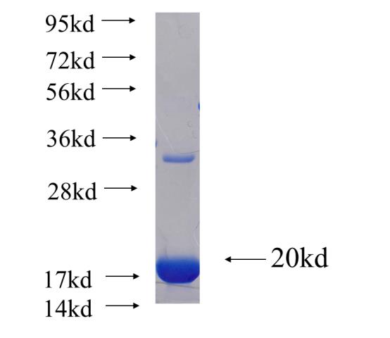 Recombinant human ALDH9A1 SDS-PAGE