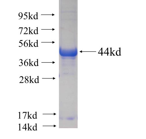 Recombinant human COL4A6 SDS-PAGE