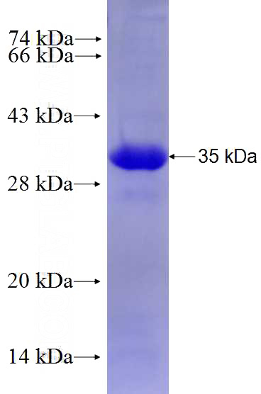 Recombinant Human PSMG2 SDS-PAGE