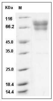 Human Coagulation Factor IX / FIX / F9 Protein (His Tag) SDS-PAGE