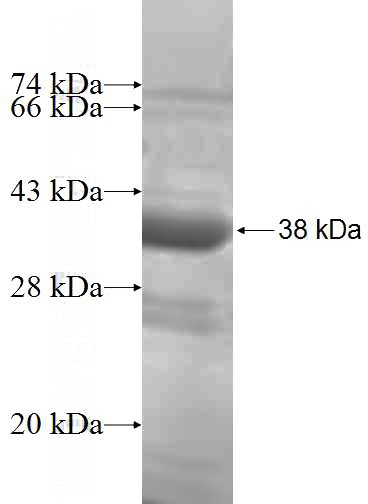 Recombinant Human NF45 SDS-PAGE