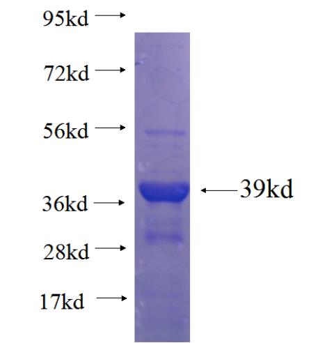 Recombinant Arabidopsis thaliana CARK1 SDS-PAGE