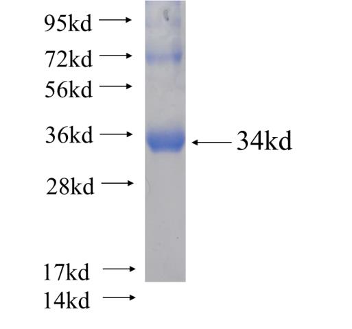 Recombinant human DHRS11(Full length) SDS-PAGE