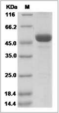 Human OBP2B Protein (Fc Tag)