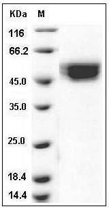 Human IL-1R9 / IL1RAPL2 Protein (His Tag) SDS-PAGE