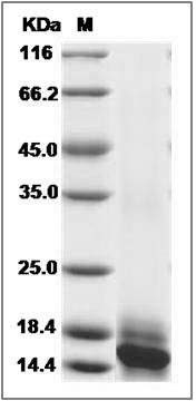 Human IL-15 / IL15 / Interleukin 15 Protein (His Tag) SDS-PAGE