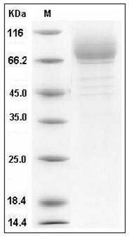 Human CD36 / SCARB3 Protein (His Tag) SDS-PAGE