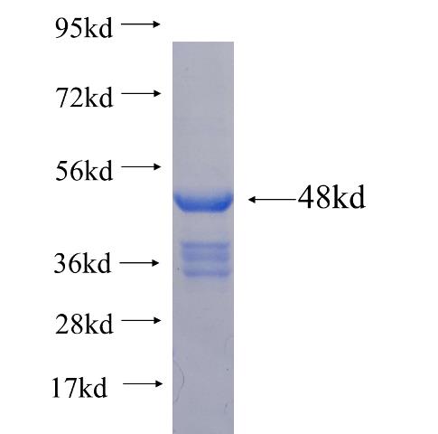 Recombinant human ACTRT2(Full length) SDS-PAGE