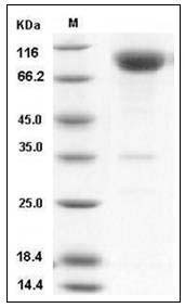 Human CD200R1 Protein (His & Fc Tag) SDS-PAGE