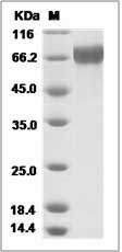 Influenza A H3N2 (A/Hanoi/EL201/2009) Hemagglutinin / HA Protein (His Tag)