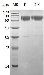 Human SERPINA3/AACT/GIG24/GIG25 (His tag) recombinant protein