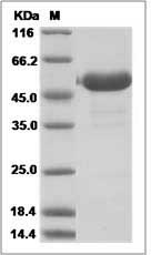 Human LRRC3B / LRP15 Protein (Fc Tag) SDS-PAGE