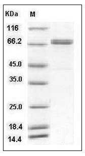 Human LRRN3 Protein (His Tag) SDS-PAGE