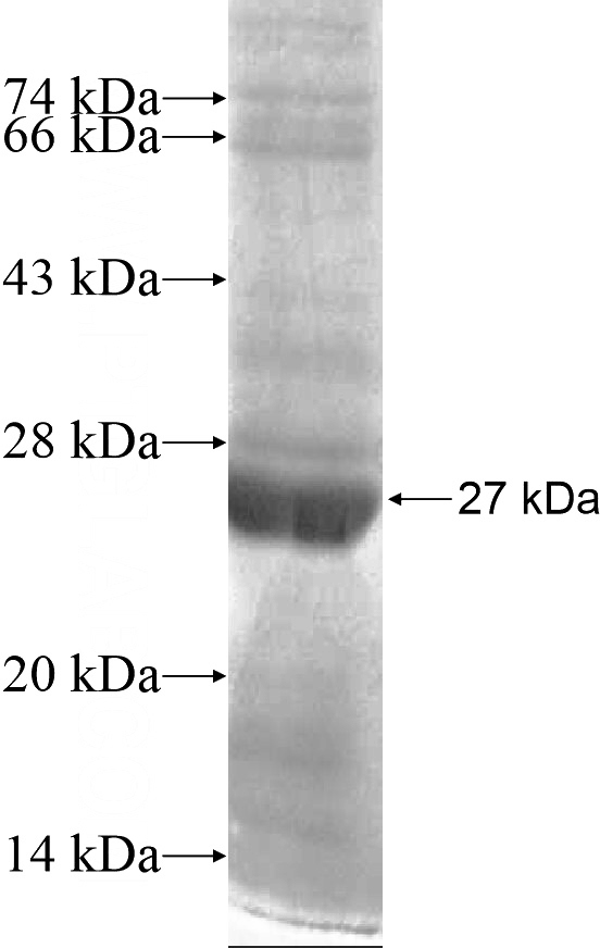 Recombinant Human LRRC8C SDS-PAGE