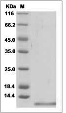 Human CD81 / TAPA-1 Protein (His Tag)