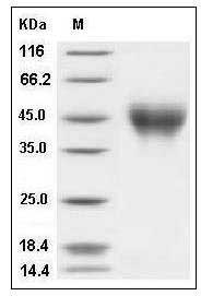 Human IFNAR2 / IFNABR Protein (His Tag) SDS-PAGE