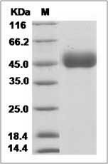 Influenza A H10N3 (A/duck/Hunan/S11205/2012) Hemagglutinin Protein (HA1 Subunit) (His Tag)