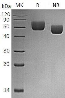 Mouse Btnl2/Gm315/Ng9 (His tag) recombinant protein