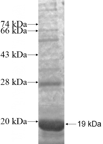 Recombinant Human SESN2 SDS-PAGE