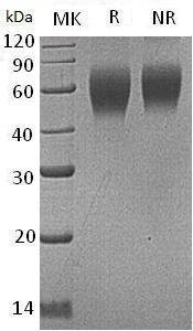Human CD200R1/CD200R/CRTR2/MOX2R (His tag) recombinant protein