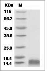 Rat CCL4 / MIP1B Protein(His Tag)