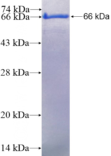 Recombinant Human CCDC93 SDS-PAGE