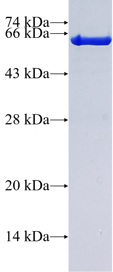 Recombinant Human ATP6V0D2 SDS-PAGE