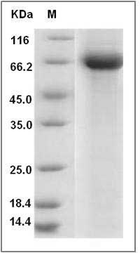 Influenza A H9N2 (A/Chicken/Hong Kong/G9/97) Hemagglutinin / HA Protein (His Tag) SDS-PAGE