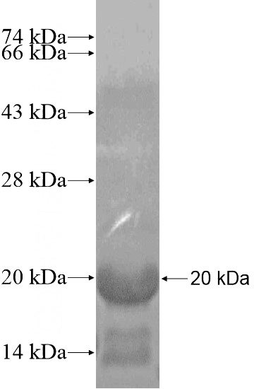 Recombinant Human DSCR6 SDS-PAGE