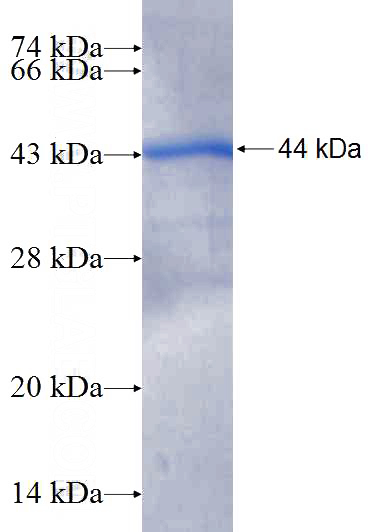 Recombinant Human PLA2G4C SDS-PAGE