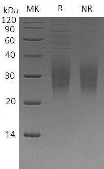 Human TREM2 (His tag) recombinant protein