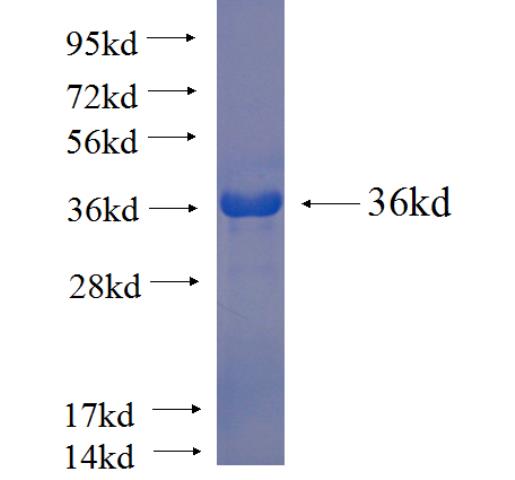 Human TEX264 Recombinant protein (His tag)