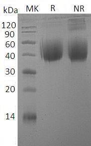 Human IL4R/IL4RA/582J2.1 (His tag) recombinant protein