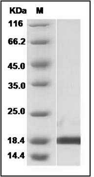 Human PIN1 / Rotamase Pin1 Protein SDS-PAGE